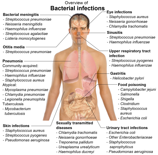 Infectious Diseases Viral Fungal And Parasitic Disease Overview