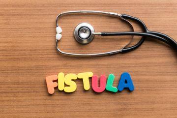 Classification and Management of Fistulas